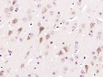 CD155 Rabbit Polyclonal Antibody