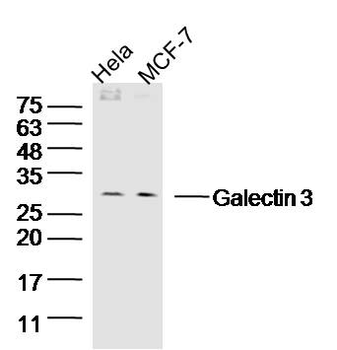 Galectin 3 Rabbit Polyclonal Antibody