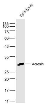 Acrosin Rabbit Polyclonal Antibody