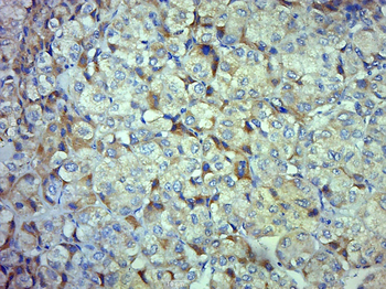 Cystatin A Rabbit Polyclonal Antibody