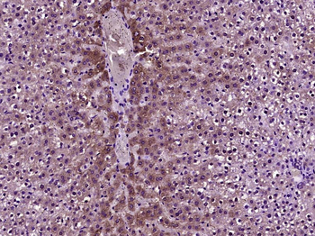 CYP3A4 Rabbit Polyclonal Antibody