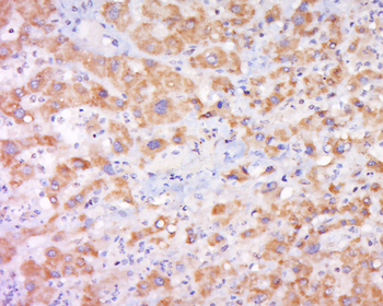 Cytochrome b245 Light Chain Rabbit Polyclonal Antibody
