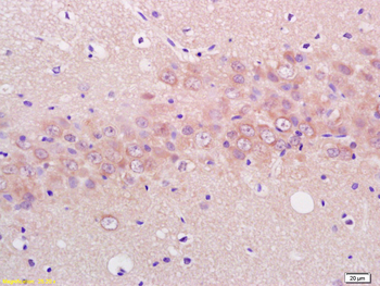 ENO3 Rabbit Polyclonal Antibody