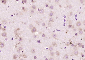 FADS1 Rabbit Polyclonal Antibody