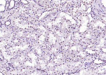Phospho-FGFR1 (Tyr307) Rabbit Polyclonal Antibody