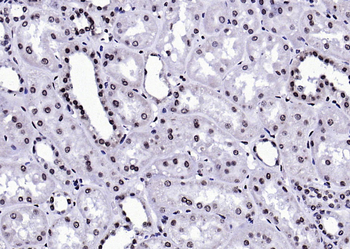 Phospho-FGFR1 (Tyr307) Rabbit Polyclonal Antibody