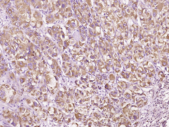 IFNB1 Rabbit Polyclonal Antibody