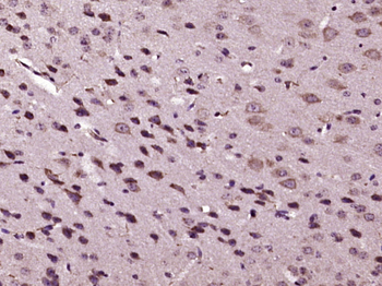 ERG/KCNH2 Rabbit Polyclonal Antibody