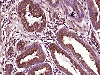 TAK1/MAP3K7 Rabbit Polyclonal Antibody