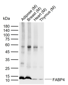 FABP4 Mouse Monoclonal Antibody