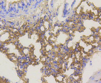 Phospho-Akt1 (Ser473) Recombinant Rabbit Monoclonal Antibody