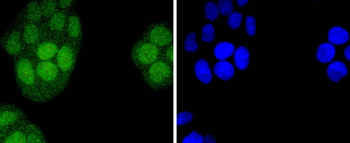 IRF2 Recombinant Rabbit Monoclonal Antibody