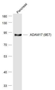 ADAM17 Recombinant Rabbit Monoclonal Antibody
