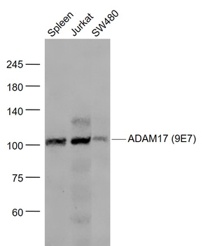 ADAM17 Recombinant Rabbit Monoclonal Antibody