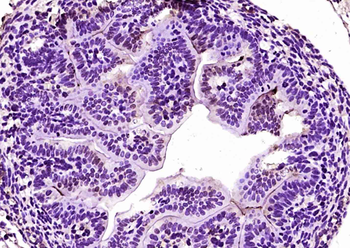 MYF5 Rabbit Polyclonal Antibody