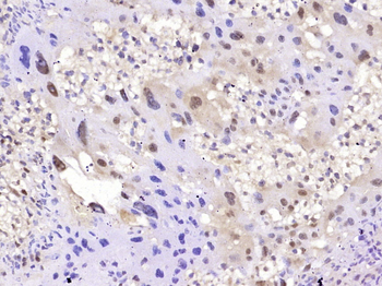 PPAR gamma Mouse Monoclonal Antibody