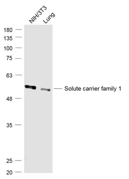 SLC1A5 Rabbit Polyclonal Antibody