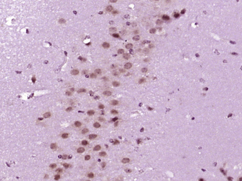 ABCG1 Rabbit Polyclonal Antibody