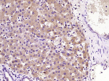 Neutrophil Elastase Rabbit Polyclonal Antibody