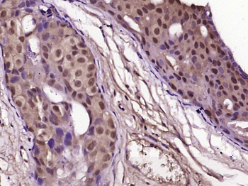 IRAK1 Rabbit Polyclonal Antibody