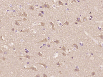 BMP7 Rabbit Polyclonal Antibody