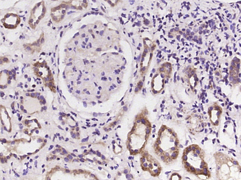 BMP7 Rabbit Polyclonal Antibody