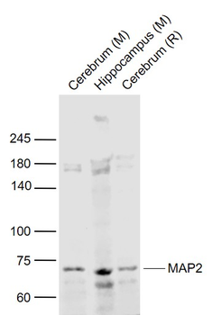 MAP2 Rabbit Polyclonal Antibody