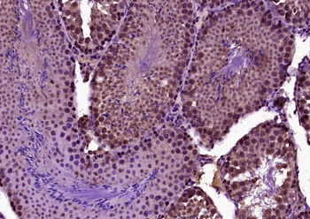 BNC1 Rabbit Polyclonal Antibody