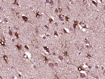 Cystatin C Mouse Monoclonal Antibody