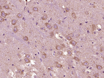 Phospho-DDIT3 (Ser30) Rabbit Polyclonal Antibody