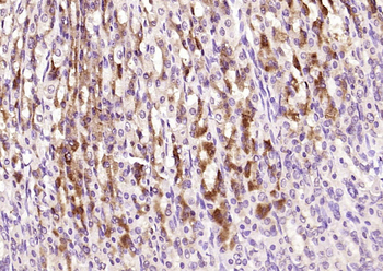 GALT Rabbit Polyclonal Antibody
