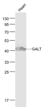 GALT Rabbit Polyclonal Antibody