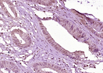 GDIA1 Rabbit Polyclonal Antibody