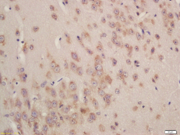 GSTA3 Rabbit Polyclonal Antibody