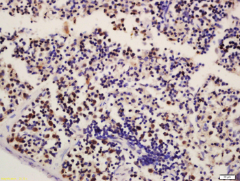 HCLS1 Rabbit Polyclonal Antibody