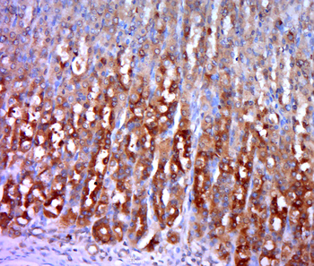 Hexokinase 1 Rabbit Polyclonal Antibody