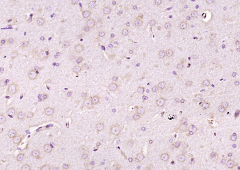 PTN Rabbit Polyclonal Antibody
