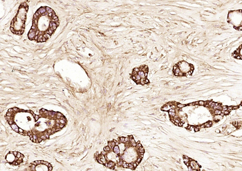 Wnt1 Rabbit Polyclonal Antibody