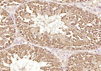 Wnt1 Rabbit Polyclonal Antibody
