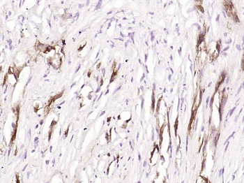 CD31 (ready to use) Mouse Monoclonal Antibody