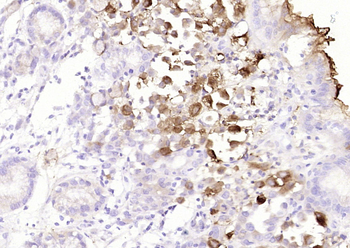 CEA (ready to use) Mouse Monoclonal Antibody