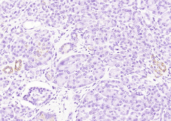 CEA (ready to use) Mouse Monoclonal Antibody