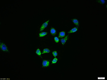 Phospho-HSP27 (Ser78) Rabbit Polyclonal Antibody