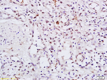 Phospho-HSP90 alpha (Thr5 + Thr7) Rabbit Polyclonal Antibody