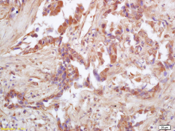 IDH2 Rabbit Polyclonal Antibody