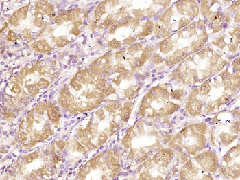 Phospho-IGF1R (Tyr980) Rabbit Polyclonal Antibody