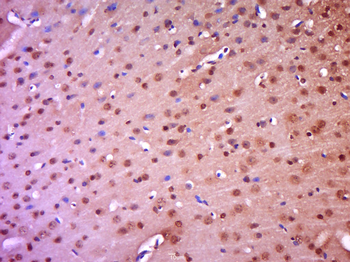 Phospho-IKB alpha (Tyr305) Rabbit Polyclonal Antibody