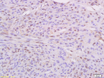 IKBKE/IKKi/IKKe Rabbit Polyclonal Antibody