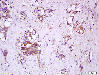 IL17RC Rabbit Polyclonal Antibody