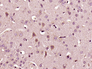 IL-22 Rabbit Polyclonal Antibody